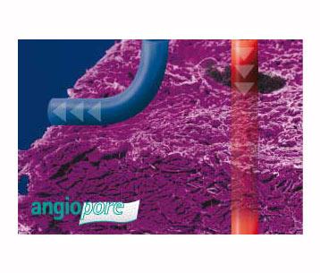 Angiopore